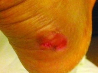 CBA球员抱怨李宁鞋质量太差 后脚跟险被磨烂