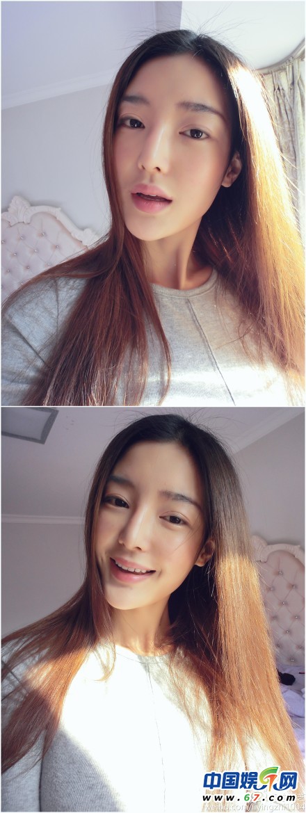 整容女星之凹凸脸