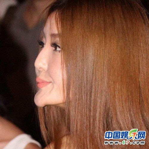 整容女星之凹凸脸