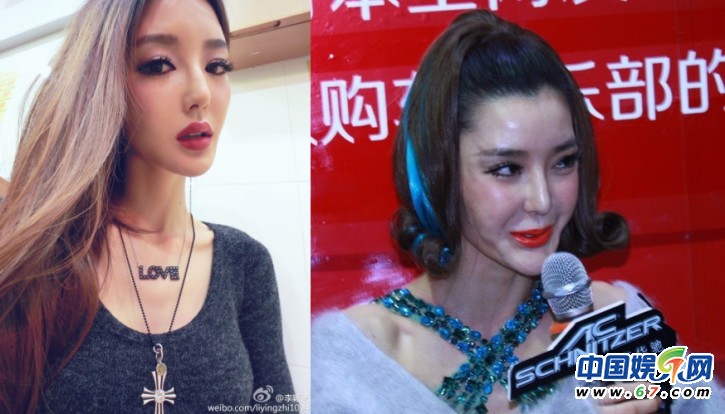 整容女星之凹凸脸