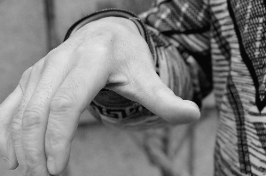 高和力受伤的大拇指下方的肌肉萎缩了 本报记者 毕继红 摄