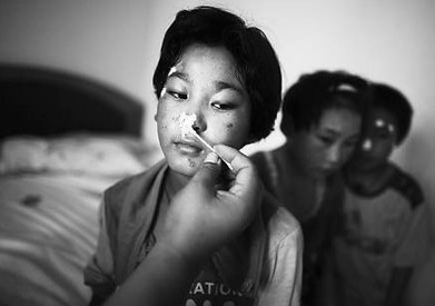 儿童药剂缺乏 大人药减量给孩子吃等于做实验