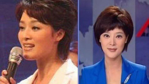 史上最全女主播整容前后对比照 网友：膜拜柳岩