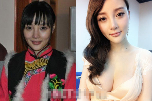 女星模样越变越糟心:杨幂舍清纯要巨乳 萧蔷变塑料脸