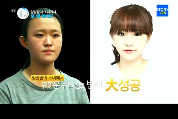 韩国整容节目惊现芭比娃娃 整容成瘾3年100次手术