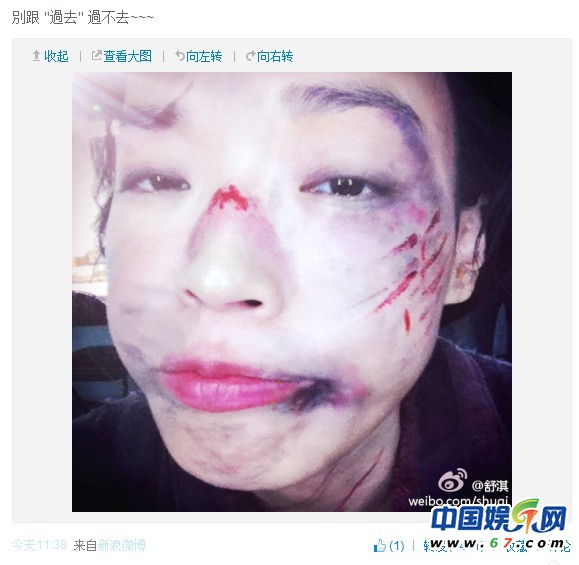 舒淇微博自曝受虐图 网友：冯德伦恨你的过去(图)