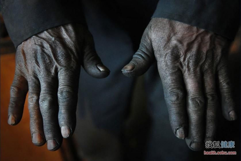 看被癌症村侵蚀的中国地图 悲痛 看被癌症村侵蚀的中国地图 悲痛