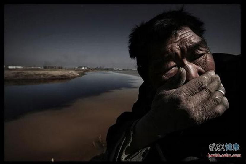 看被癌症村侵蚀的中国地图 悲痛 看被癌症村侵蚀的中国地图 悲痛