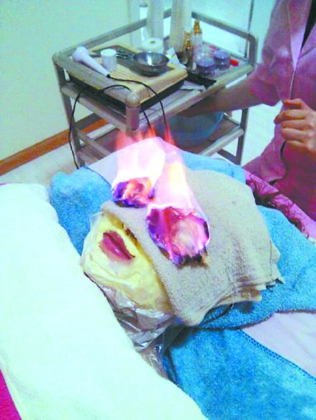 女子美容眼睛上方点火活血 女子美容眼睛上方点火活血