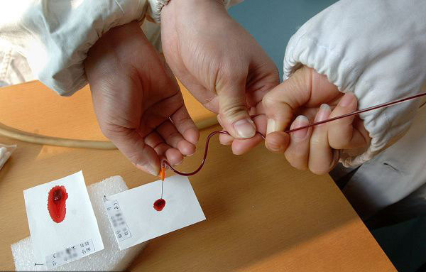 DNA亲子鉴定全过程实拍