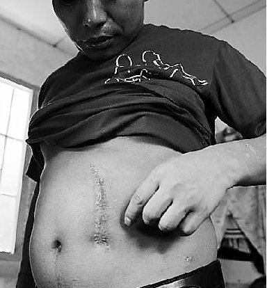 浙江买卖器官案9被告6人卖掉自己肾