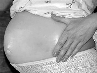 女子戴“假肚皮”装孕妇占座时脱落 向工商投诉被拒