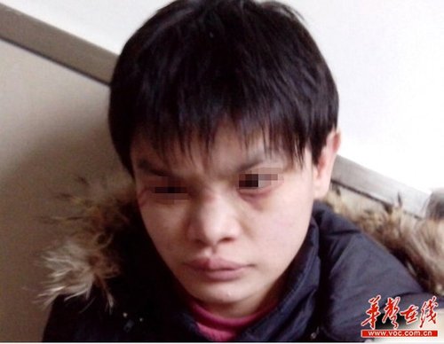 近日,十堰市儿童福利院被曝虐待儿童,其中7名儿童在2012年冬季被活活冻死,引发广泛关注。 网络截图 近日,十堰市儿童福利院被曝虐待儿童,其中7名儿童在2012年冬季被活活冻死,引发广泛关注。 网络截图