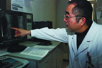 跑步减肥 关节炎找上门