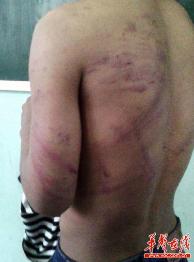 目前被体罚学生已经回校上课，涉事老师被责令道歉。网络截图