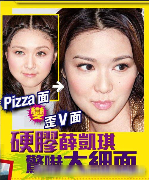 薛凯琪被曝整容圆脸变V字脸求转运 父亲病重财政压力大