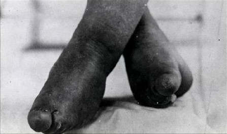 三寸金莲背后的秘密：浓含性意识