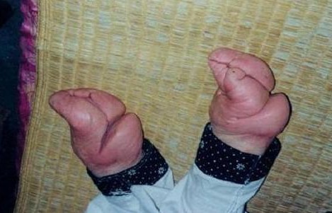 三寸金莲背后的秘密：浓含性意识