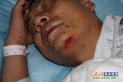 海南一市人大代表率众打人 海南一市人大代表率众打人