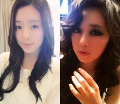 韩星洪秀雅整容致下巴发肿 网友：不忍直视