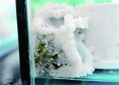 “八带妈妈”舍己产子 “八带妈妈”舍己产子