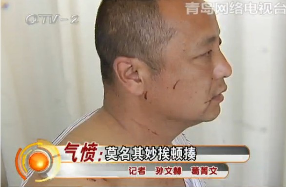 货车司机莫名其妙挨顿揍 鼻青脸肿浑身伤