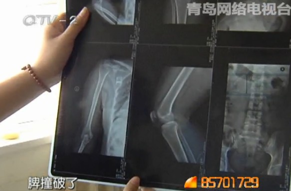 司机深夜撞人后逃逸 两名路人身受重伤