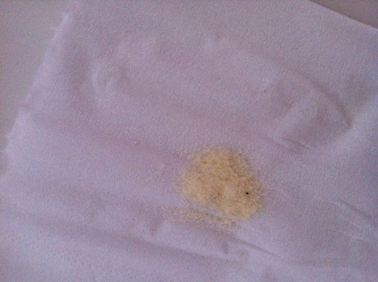 消费者在美赞臣奶粉中吃出的黑色异物 