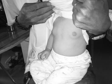 ▲小银胸部明显隆起 　　