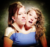 全球最不可思议的双胞胎