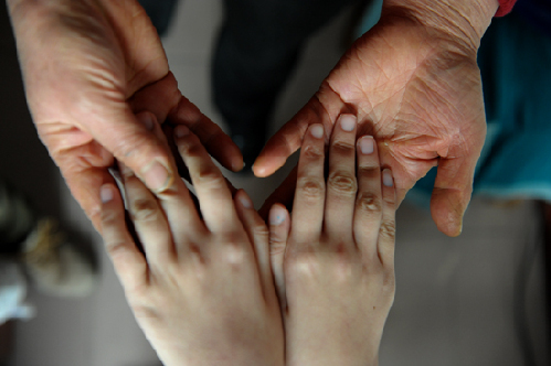 肌无力女孩王淑乾 我们给你爱的力