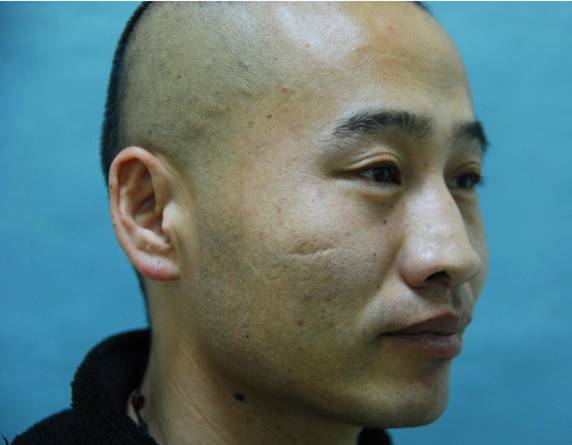 感动青岛退伍兵 请救救我的唇裂女儿 感动青岛退伍兵 请救救我的唇裂女儿