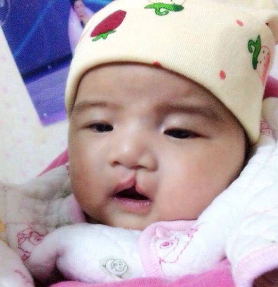 感动青岛退伍兵 请救救我的唇裂女儿 感动青岛退伍兵 请救救我的唇裂女儿