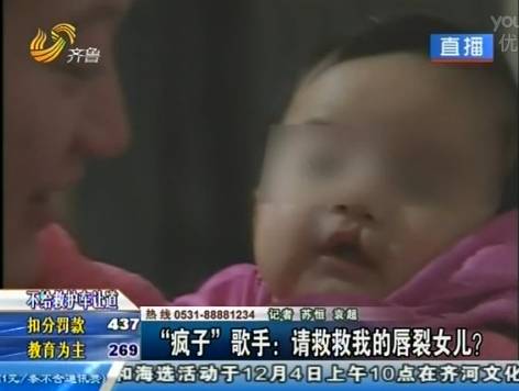 感动青岛退伍兵 请救救我的唇裂女儿 感动青岛退伍兵 请救救我的唇裂女儿