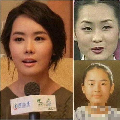 韩国女星整容变脸对比照：李多海尹恩惠变化惊人
