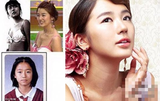 韩国女星整容变脸对比照：李多海尹恩惠变化惊人