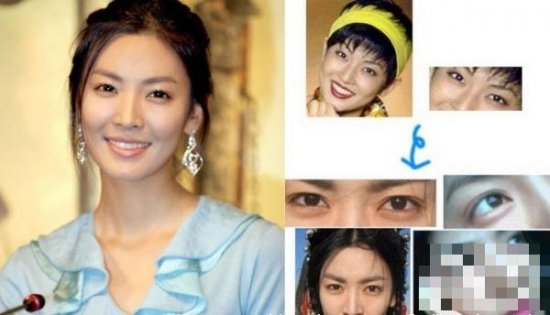 韩国女星整容变脸对比照：李多海尹恩惠变化惊人