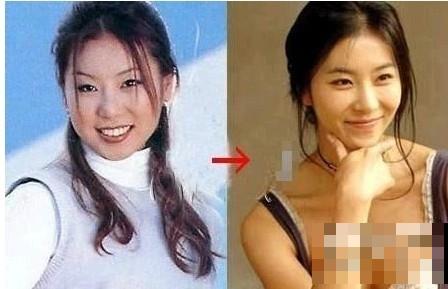 韩国女星整容变脸对比照：李多海尹恩惠变化惊人