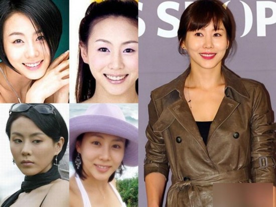 韩国女星整容变脸对比照：李多海尹恩惠变化惊人