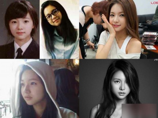 韩国女星整容变脸对比照：李多海尹恩惠变化惊人