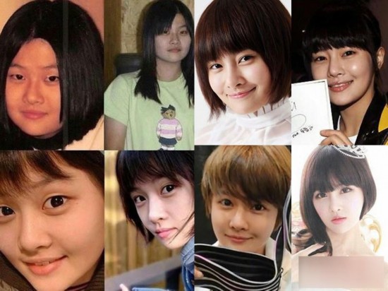 韩国女星整容变脸对比照：李多海尹恩惠变化惊人
