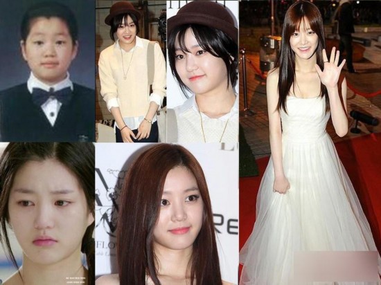 韩国女星整容变脸对比照：李多海尹恩惠变化惊人