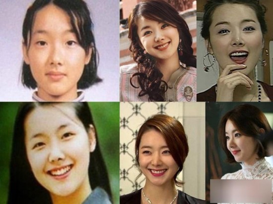 韩国女星整容变脸对比照：李多海尹恩惠变化惊人