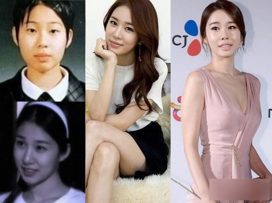 韩国女星整容变脸对比照：李多海尹恩惠变化惊人