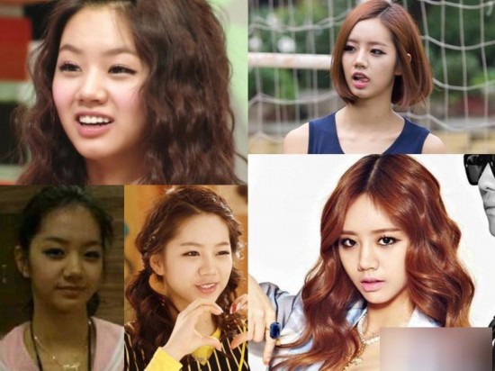 韩国女星整容变脸对比照：李多海尹恩惠变化惊人