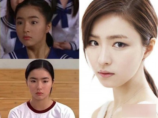 韩国女星整容变脸对比照：李多海尹恩惠变化惊人