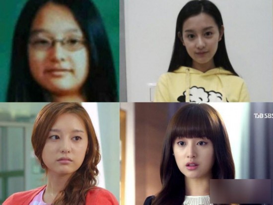 韩国女星整容变脸对比照：李多海尹恩惠变化惊人