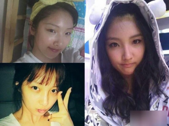 韩国女星整容变脸对比照：李多海尹恩惠变化惊人