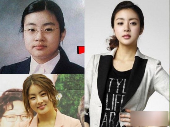 韩国女星整容变脸对比照：李多海尹恩惠变化惊人