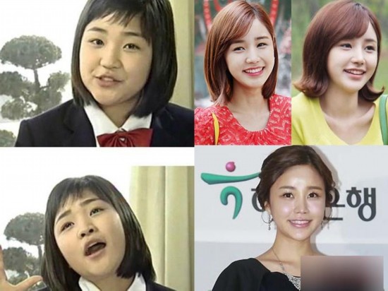 韩国女星整容变脸对比照：李多海尹恩惠变化惊人